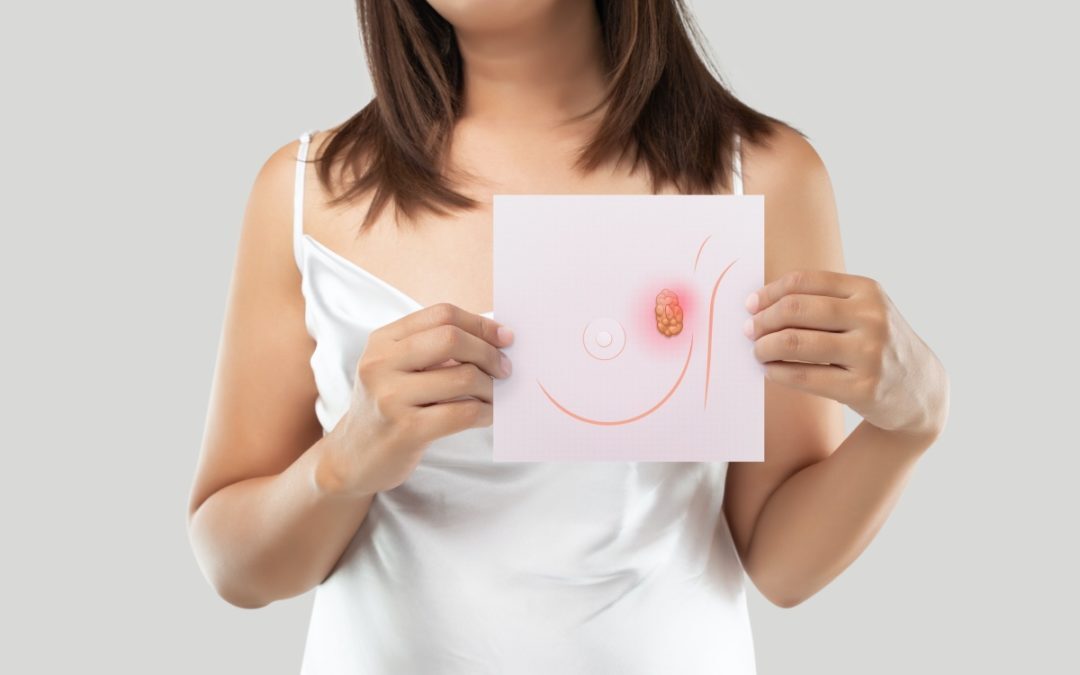 Prevenzione del tumore al seno: come effettuare l’autopalpazione