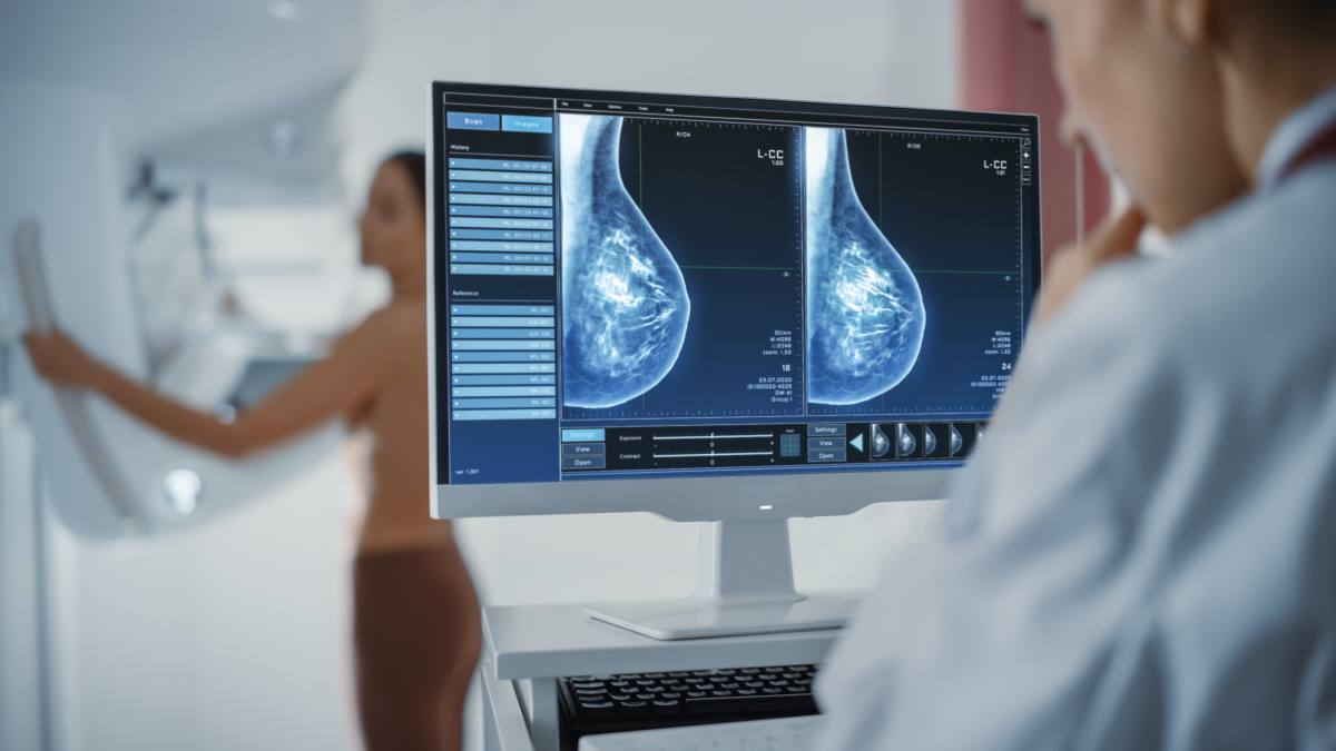 tumore mammario diagnosi precoce mammografia