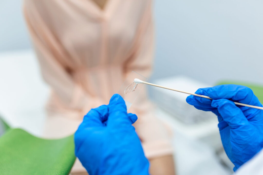 raccolta campione Pap test