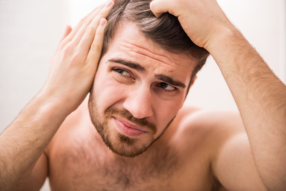 inizio caduta dei capelli in un uomo