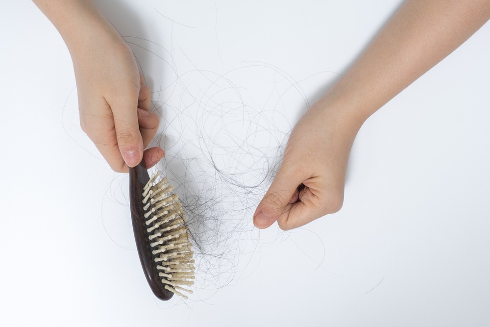 Una spazzola piena di capelli segno riconducibile alla caduta dei capelli