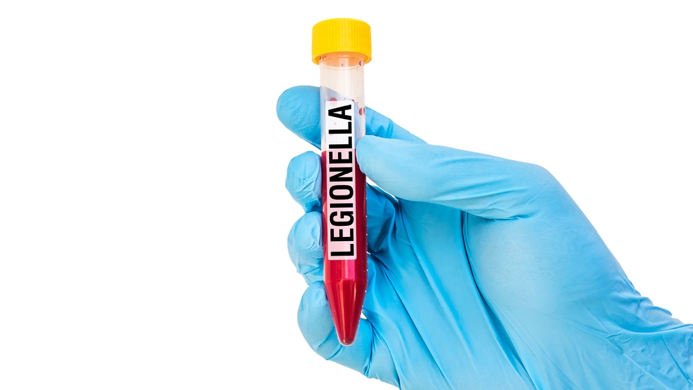 Provetta con campione per il test di Legionella