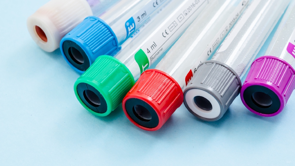 Terapia TAO Terapia Anticoagulante Orale