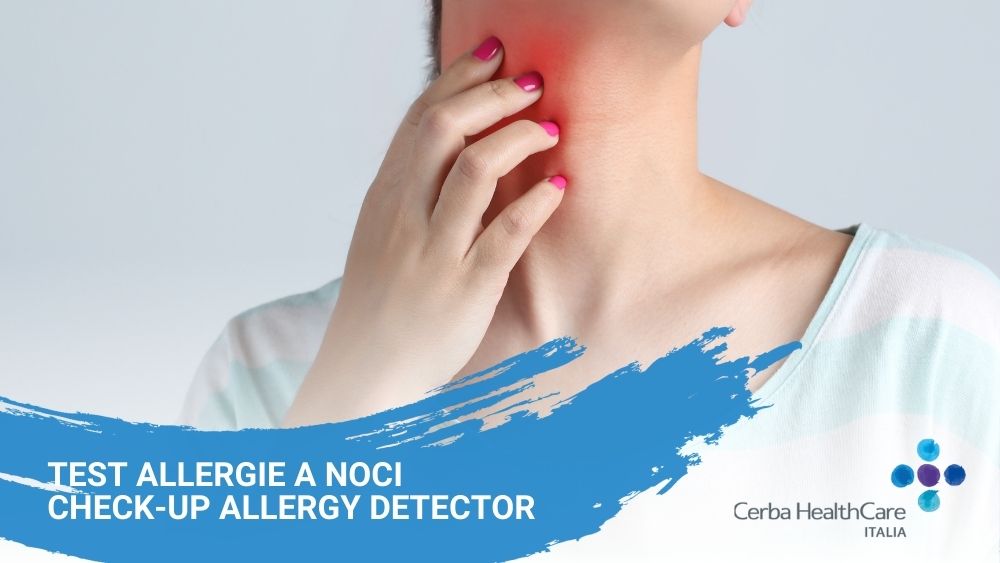 Test allergie a Noci, check-up Allergy Detector