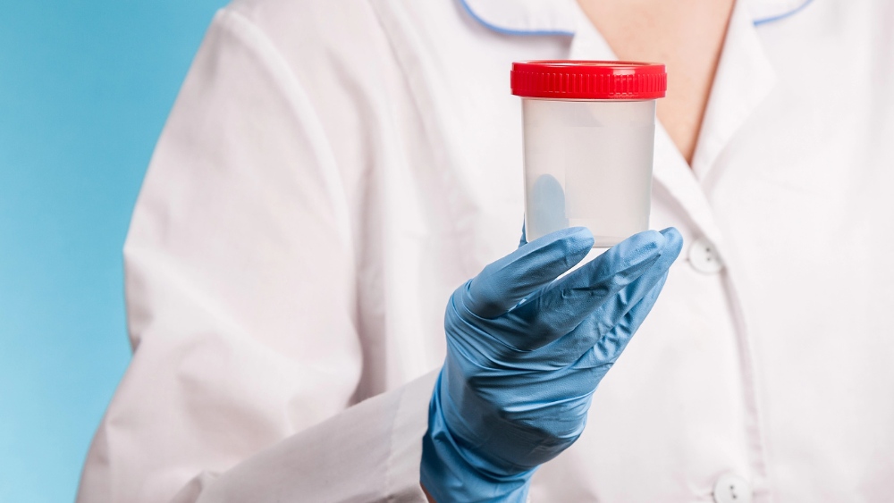 Esame delle feci, uno strumento diagnostico essenziale per la salute gastrointestinale