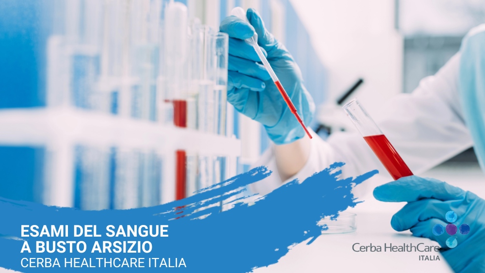 Esami del sangue a Busto Arsizio