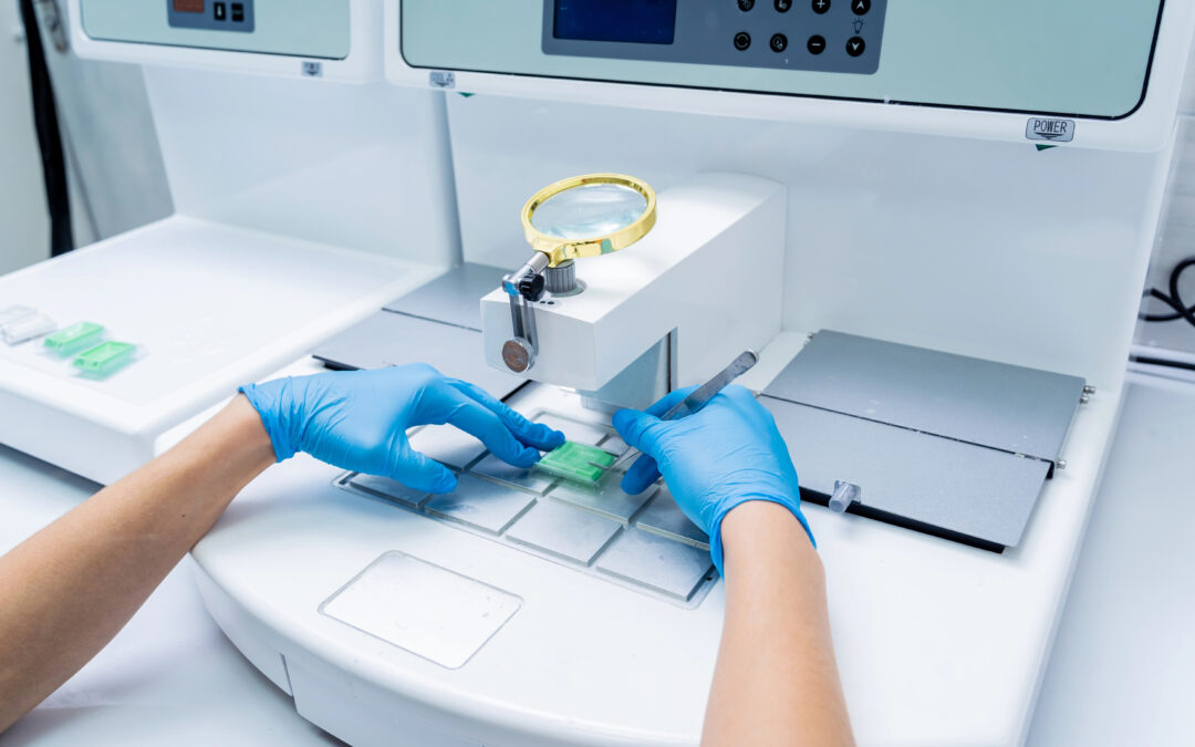 Pap test: un formidabile test per la prevenzione del cancro della cervice uterina